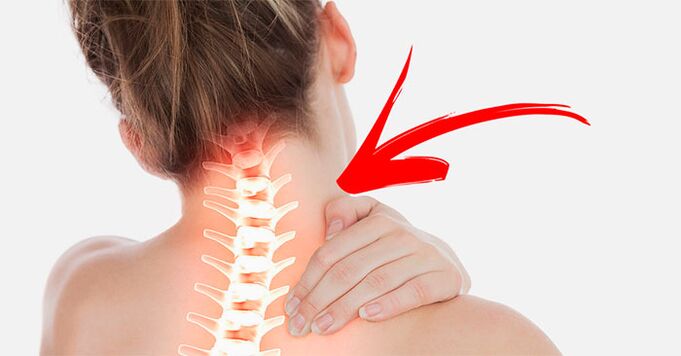 bolečine v vratu zakaj in kaj storiti